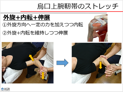 烏口上腕靭帯のストレッチ